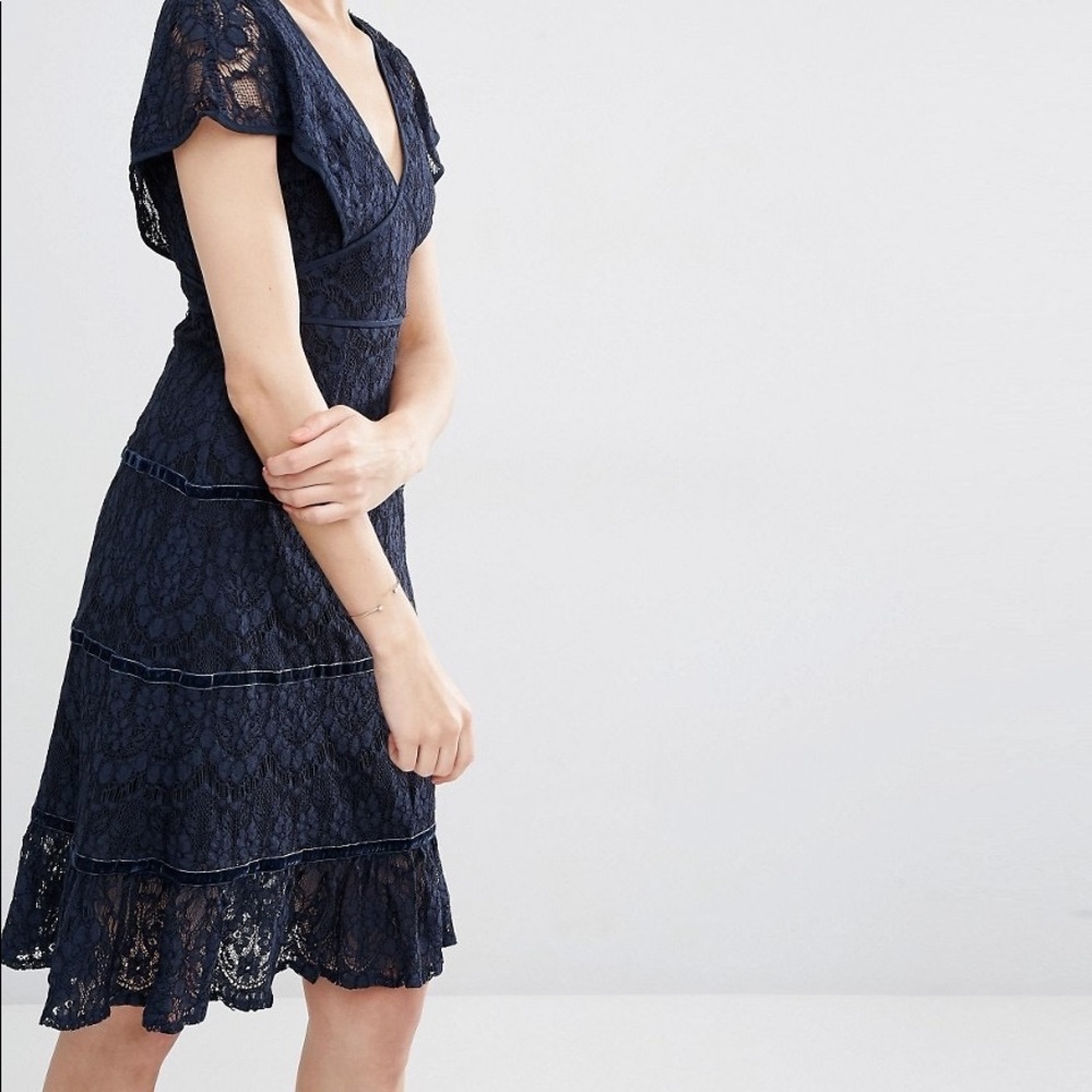 foxiedox blue lace dress Anthropologie Midi Navy izod dress shirts